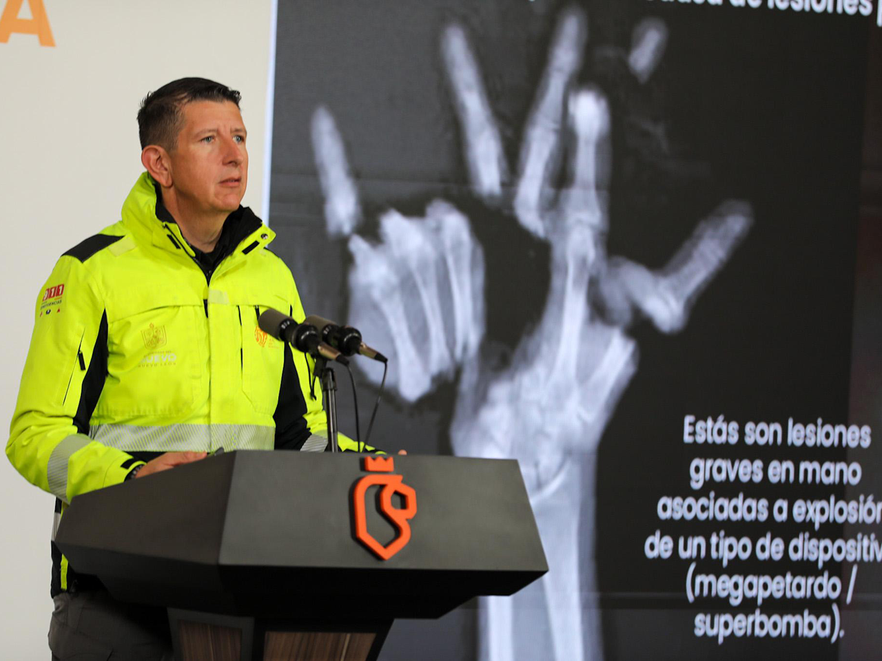 Emite PCNL recomendaciones para prevenir incendios en temporada decembrina